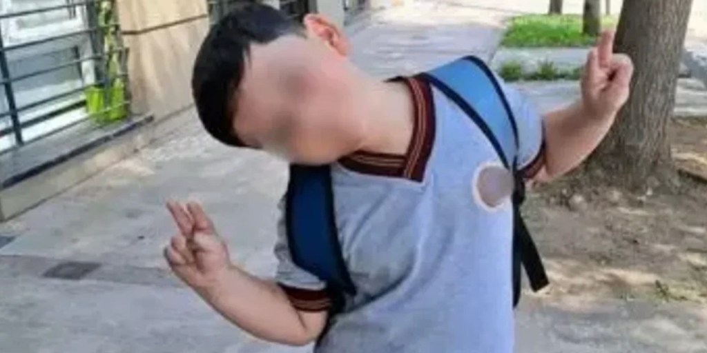 Nueva intervención quirúrgica para el pequeño Bastián en medio de una compleja&nbsp;recuperación